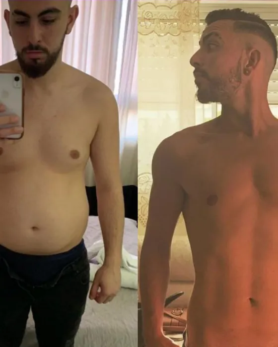 לפני ואחרי בשיטת ריקומפוזישן לצדדים